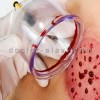 قیمت حجامت تخصصی