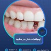 ایمپلنت دندان در مشهد با اقساط بلندمدت و شرایط ویژه