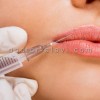 قیمت تزریق ژل لب