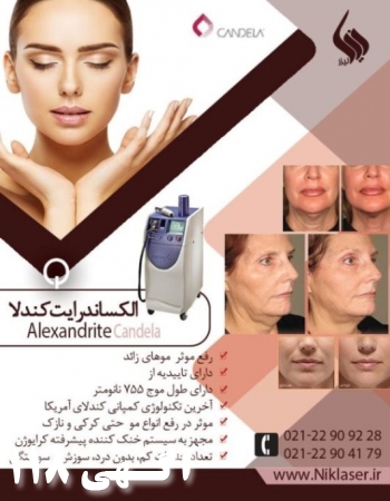 اجاره دستگاه الکساندرایت کندلا