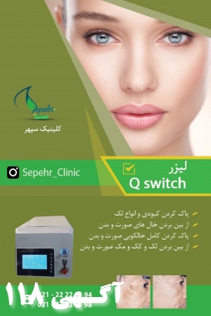 کیوسوئیچ Qswitch