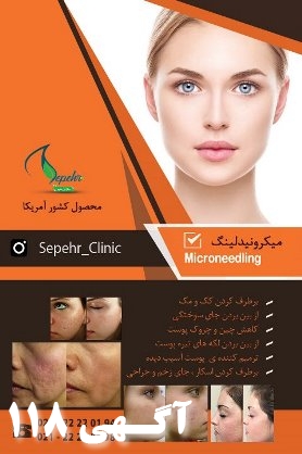 میکرونیدلینگ Microneedling