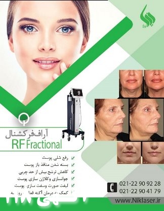 اجاره آراف فرکشنال برای درمان استریا