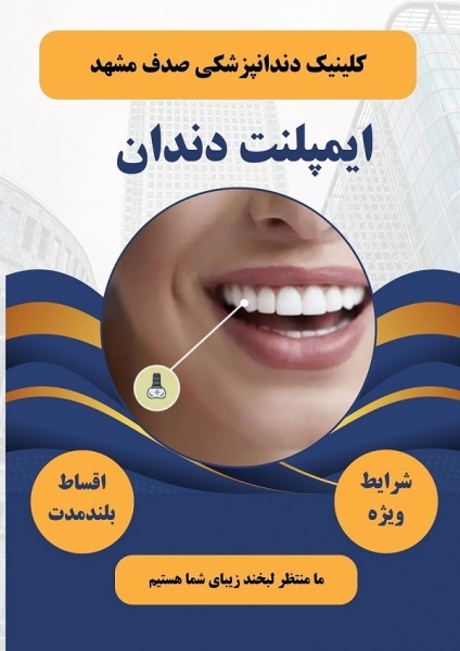 ایمپلنت دندان در مشهد با اقساط بلند مدت، بدون پیش پرداخت