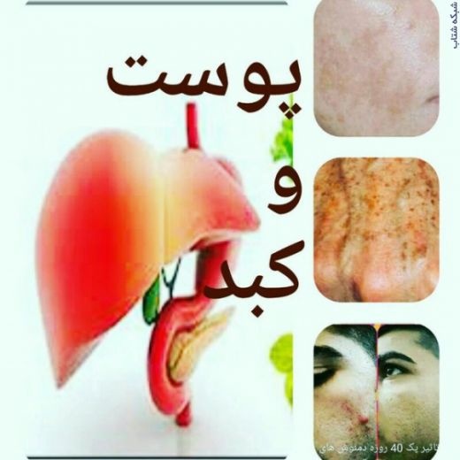فروش انواع دمنوش لاغری افزایش اشتها پاکسازی کبد پا