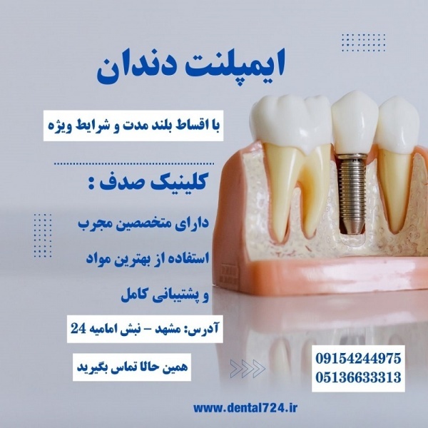 کاشت ایمپلنت بدون فشار مالی با اقساط بلند مدت