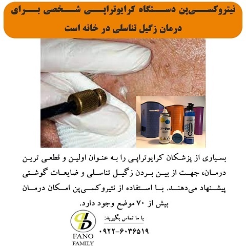 کرایوتراپی زگیل تناسلی را بصورت شخصی