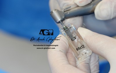 دکتر آرش غفوری | مرکز ایمپلنت رشت